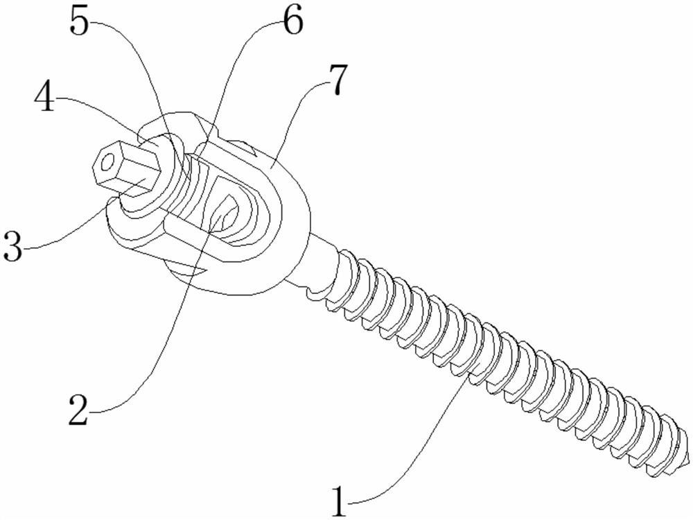 选择性椎弓根螺钉-专利